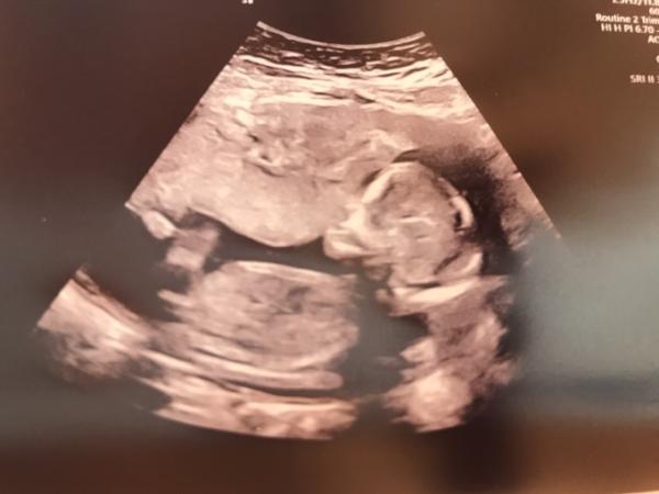 Bild zu Nub-Experten - Forum für August - Mamis