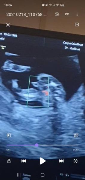 Bild zu Überglücklich 14 SSW - Geschlecht - Forum für August - Mamis
