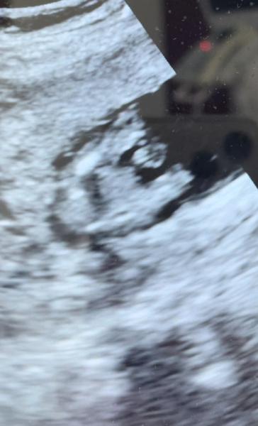 Bild zu Junge oder Mädchen? :-) - Forum für August - Mamis