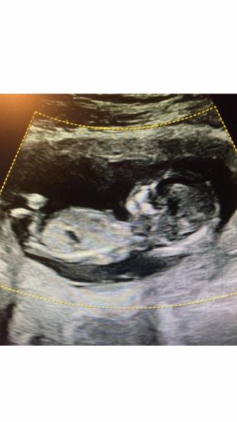Bild zu Jetzt doch neugierig.. - Forum für August - Mamis
