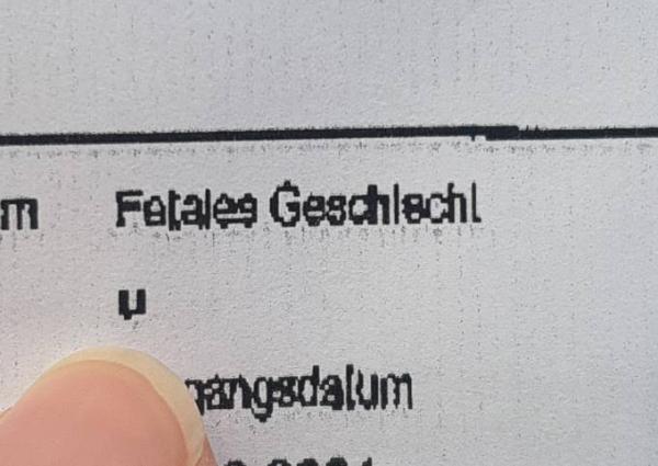 Bild zu Mädchen oder Junge :) - Forum für August - Mamis
