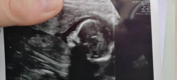 Bild zu Zurück vom neuen Frauenarzt - Forum für August - Mamis