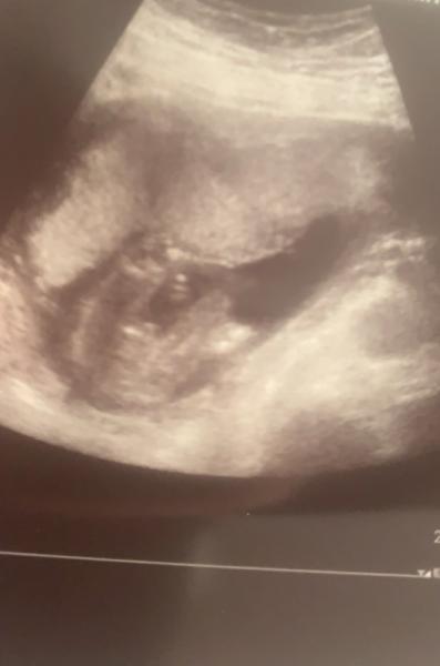 Bild zu Baby machts spannend - Forum für August - Mamis