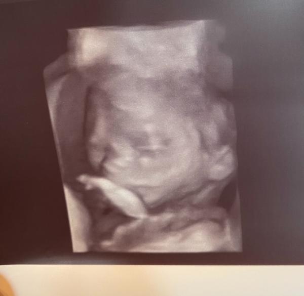 Bild zu Outing 😍😍😍 - Forum für August - Mamis