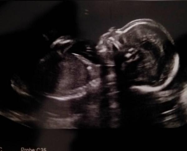 Bild zu Date mit meiner dritten Maus đź’— - Forum fĂĽr August - Mamis