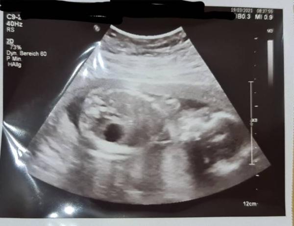 Bild zu Zurück vom Fa - Forum für August - Mamis