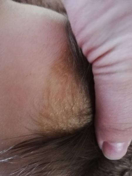 Bild zu Haarproblem - Forum für August - Mamis