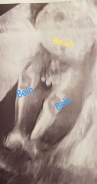 Bild zu Vermutung - Geschlecht? - Forum für August - Mamis