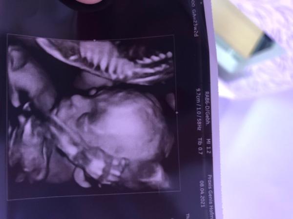 Bild zu Zwillings Update 💕 - Forum für August - Mamis