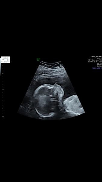 Bild zu Halbzeit & großer Ultraschall 💙 - Forum für August - Mamis