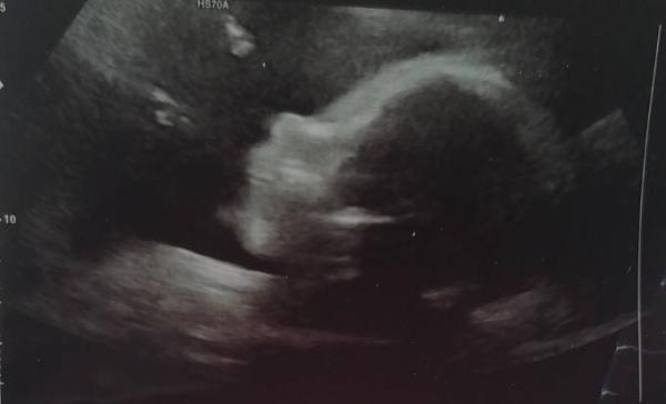 Bild zu Fa. Termin geschafft - Forum für August - Mamis