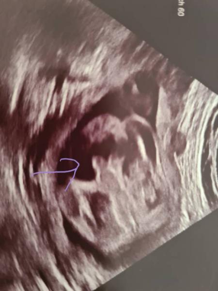 Bild zu Corona - Forum für August - Mamis