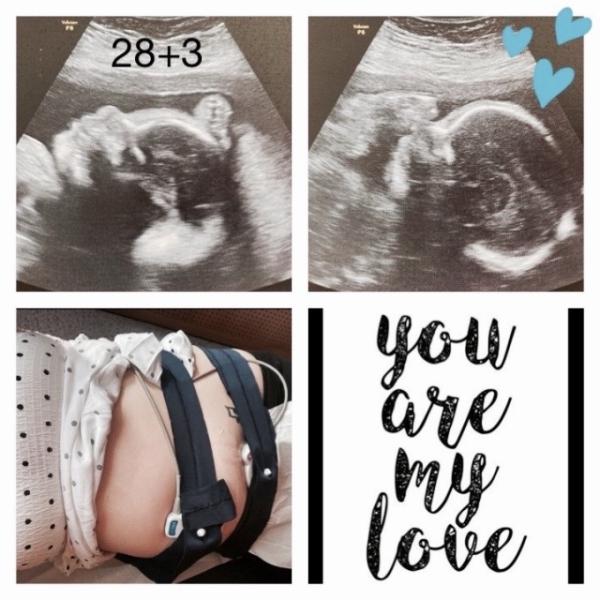Bild zu Gestern wieder Ultraschall 💙 - Forum für August - Mamis