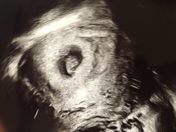 Bild zu zurück vom 1. Termin - Forum für August - Mamis