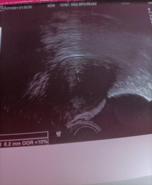Bild zu Heute erster Ultraschall... - Forum für August - Mamis