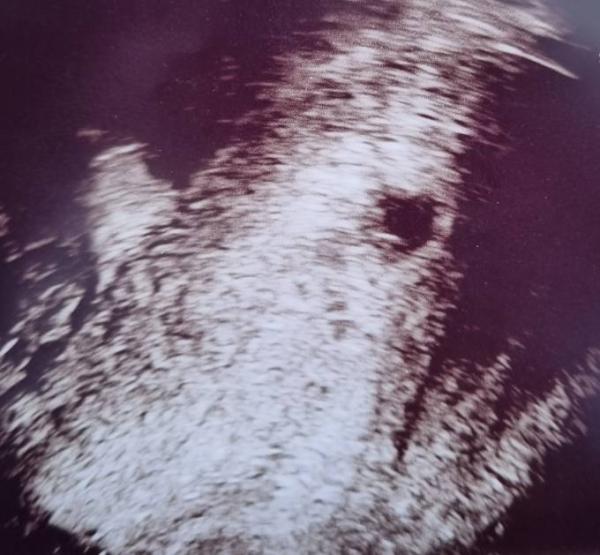 Bild zu Ich glaub ich möchte einsteigen - Forum für August - Mamis