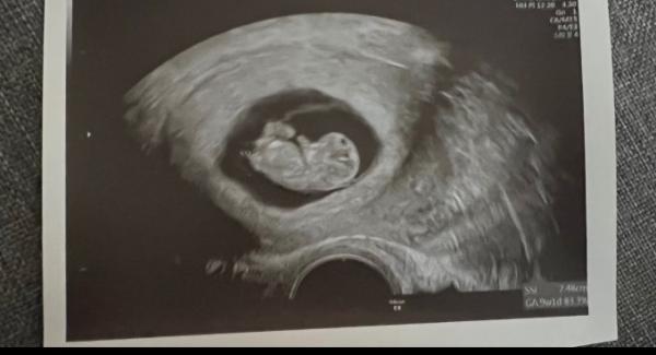 Bild zu Dem Zwerg gehts gut :) - Forum für August - Mamis