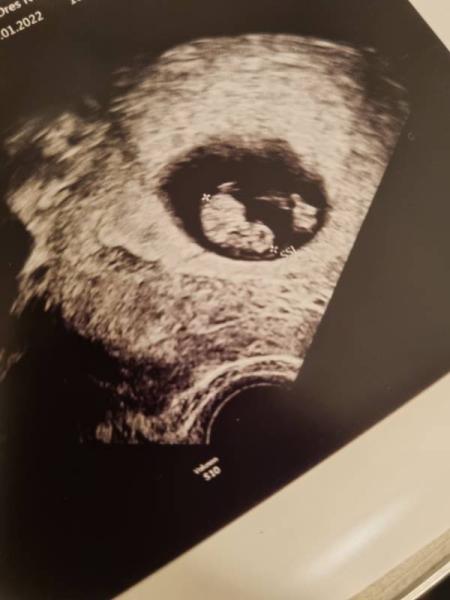 Bild zu Ich hab jetzt einen ET - Forum für August - Mamis