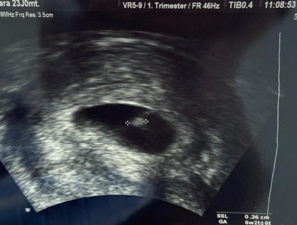 Bild zu Herzschlag ♥️😍 - Forum für August - Mamis