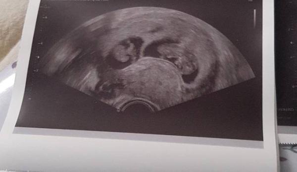 Bild zu Hallo kleine Zappelwürmer - Forum für August - Mamis