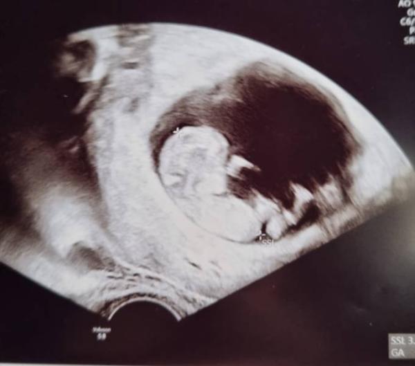 Bild zu Kleines Baby Update - Forum für August - Mamis