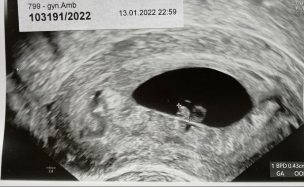Bild zu Sorgen wegen Größe 8. SSW - Forum für August - Mamis