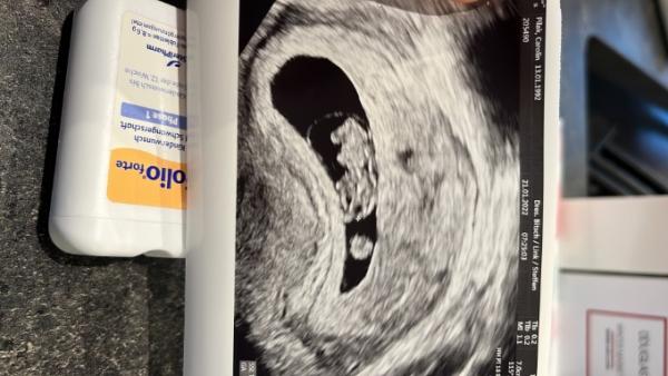 Bild zu Es ist ein Gummibärchen 😍 - Forum für August - Mamis