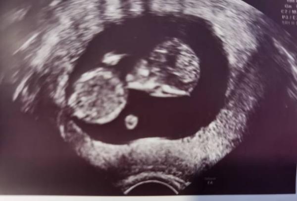 Bild zu Glücklich - Forum für August - Mamis