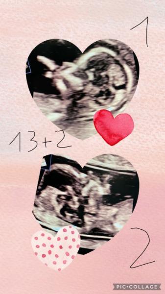 Bild zu Heute NIPT + Feindiagnostik - Forum für August - Mamis