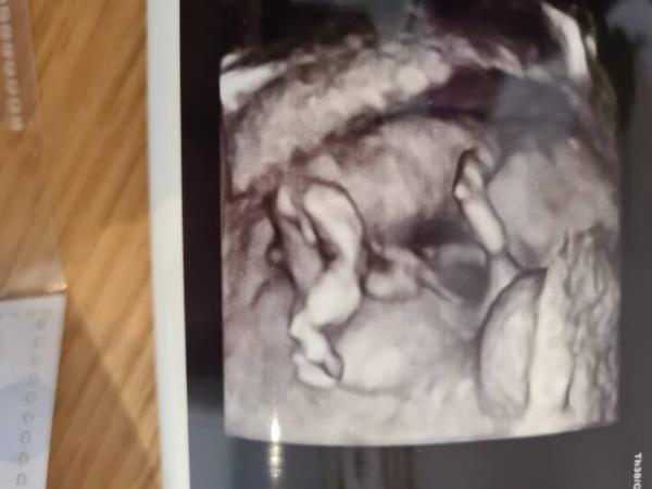 Bild zu Habt ihr ne Ahnung was wir bekommen :)? - Forum für August - Mamis