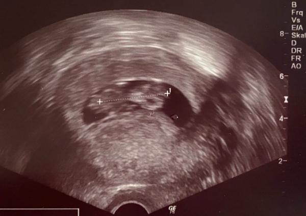 Bild zu Geschlecht - Forum für August - Mamis