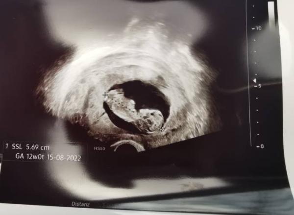 Bild zu 2. Ultraschall - ❤️ - Forum für August - Mamis