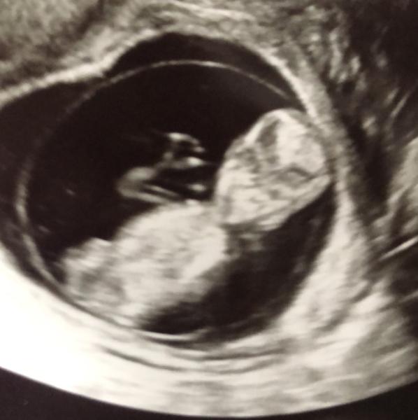 Bild zu Cuteness overload! Ultraschallbild - Forum für August - Mamis