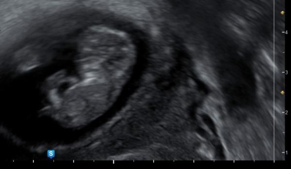 Bild zu Junge oder Mädche? - Forum für August - Mamis