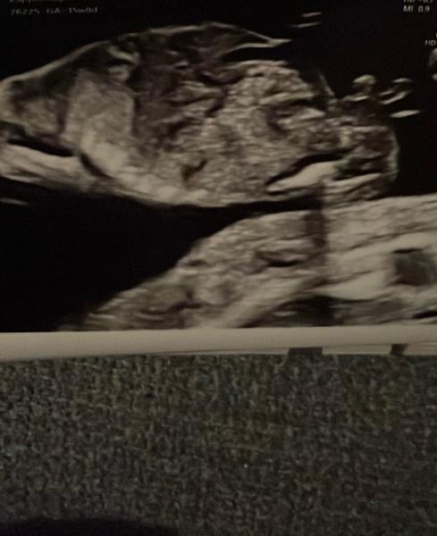 Bild zu Mädchen oder Junge - Forum für August - Mamis