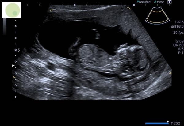 Bild zu Zurück vom ETS ❤️❤️ - Forum für August - Mamis