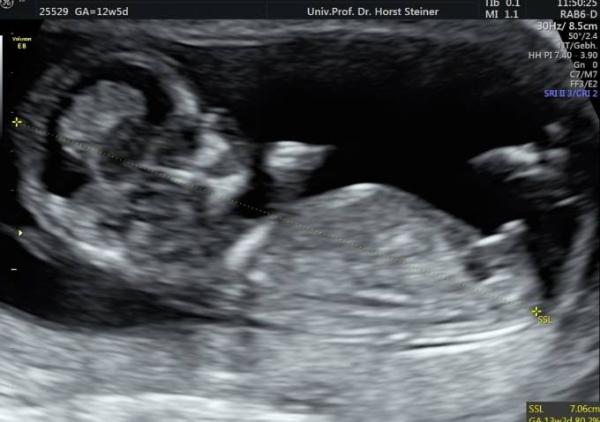 Bild zu Nachricht aus Mama 's Bauch - Forum für August - Mamis