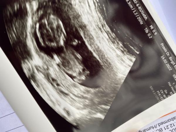 Bild zu Babygeschlecht - Forum für August - Mamis