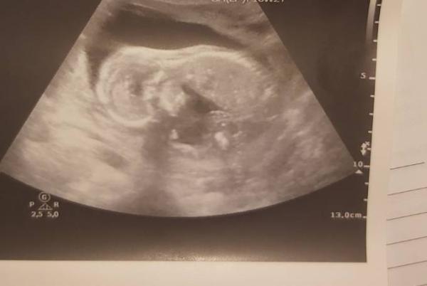 Bild zu Geschlecht - Forum für August - Mamis