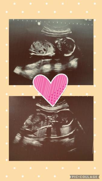 Bild zu Heute endlich wieder Termin ♥️ - Forum für August - Mamis