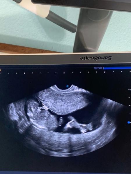 Bild zu ♥️ Oder 💙 - Forum für August - Mamis
