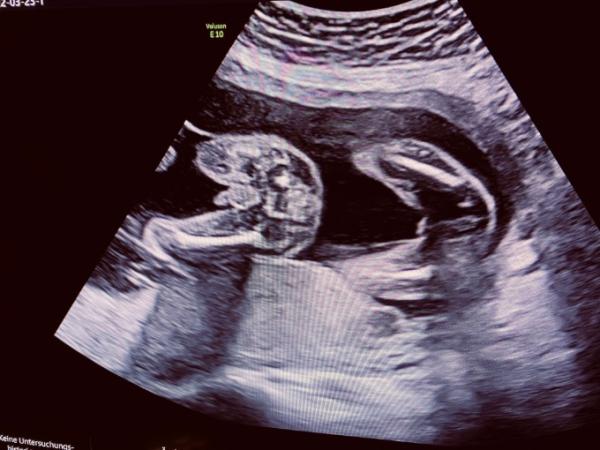 Bild zu Heute großer Organultraschall ♥️♥️ - Forum für August - Mamis