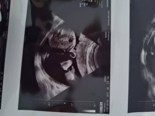 Bild zu Kindsbauch zu gross? - Forum für August - Mamis