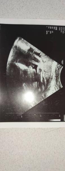 Bild zu Ultraschallbild - Forum für August - Mamis