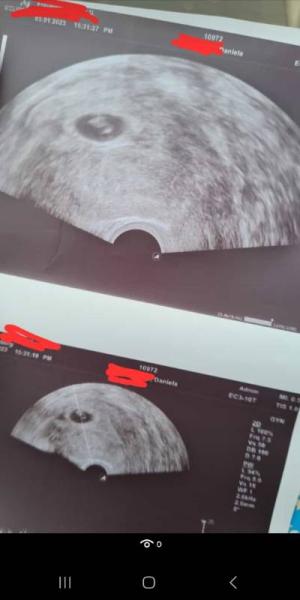 Bild zu Frauenarzt Termin - Forum für August - Mamis