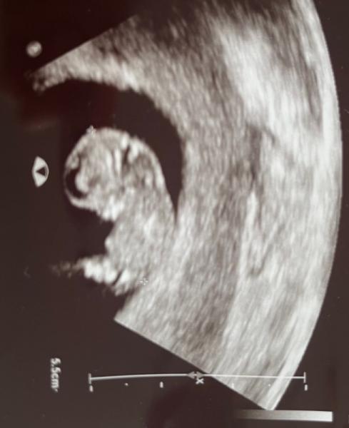 Bild zu FA-Termin - schon ein richtiges Baby - Forum für August - Mamis