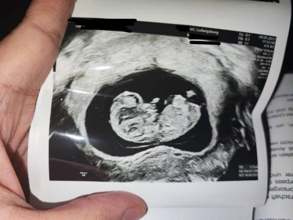 Bild zu 2 FA - Termin 🍀 - Forum für August - Mamis