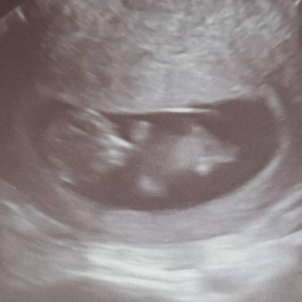 Bild zu Update aus der 11. Ssw - Forum für August - Mamis