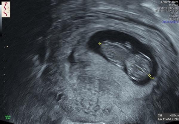 Bild zu Gestern 2. Fa Termin - Forum für August - Mamis