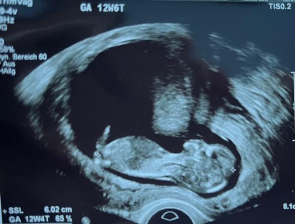 Bild zu ET bleibt beim 8.8.! :) - Forum für August - Mamis